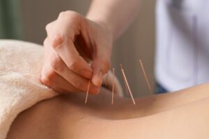 Acupuncture A Holistic Boost for Breathing and Stress